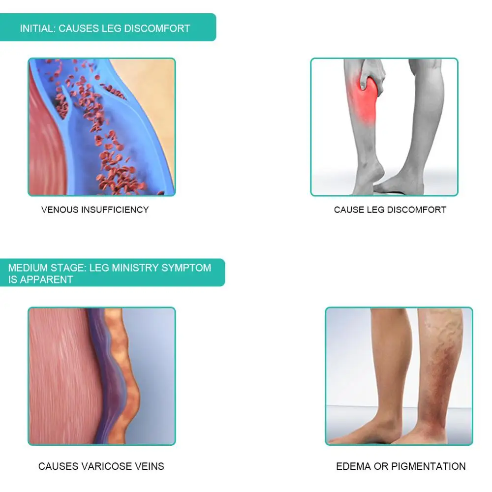 1Pair Medical Compression Sock - Compression Sock Medical review and price